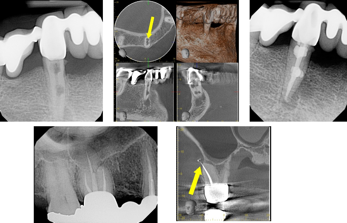 Dental CBCT Scan in El Paso, TX Westside Endodontic Associates
